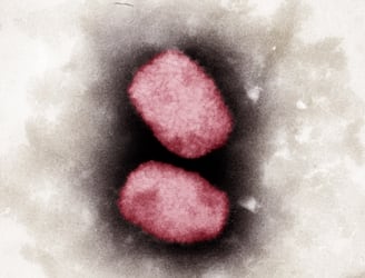 viruela del mono Monkeypox virus salud Foto: AFP.