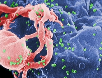Micrografía electrónica de barrido (SEM) de los viriones del VIH-1 como protuberancias redondas verdes que brotan de la superficie de una célula de linfocito cultivada, 1985.