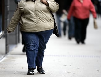 Obesidad ilustrativa AFP.