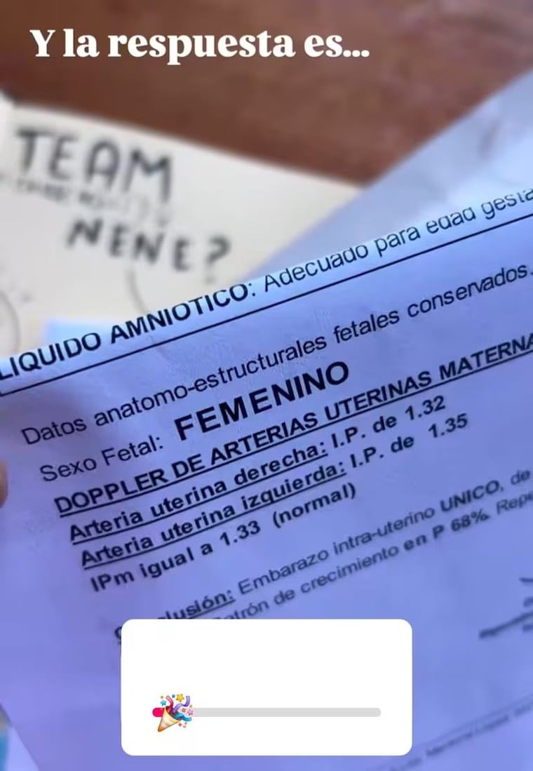 Fiorella Migliore reveló que espera una niña.