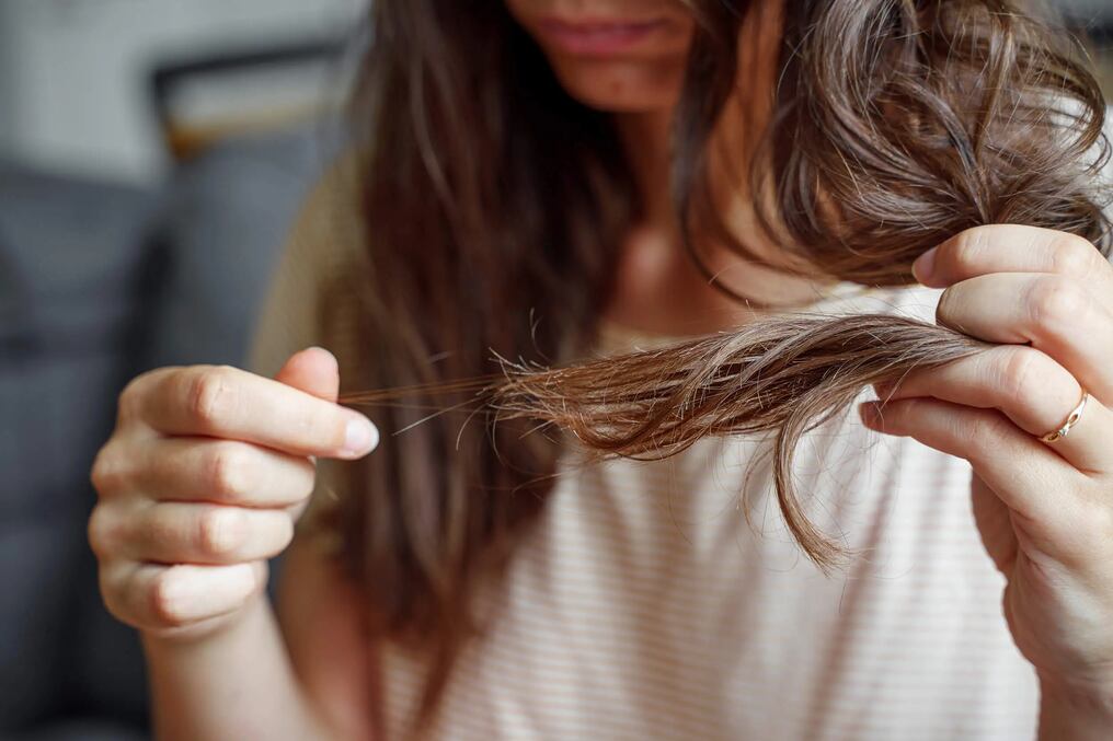 La pérdida de cabello puede ser sinónimo de falta de biotina o vitamina B7. Foto: Archivo