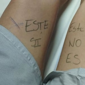 Paciente se escribió en la pierna para que cirujanos no se equivoquen