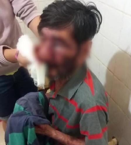 "Encontramos a la víctima con el rostro completamente golpeado y ensangrentado", indicó el oficial Osmar Cubilla. Foto: Captura de pantalla