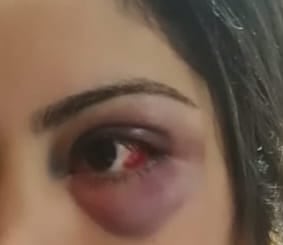 La fiscal Viviana Sánchez procesó a un hombre como supuesto autor de un hecho de brutal golpiza y amenaza con cuchillo a su pareja, ocurrido en Navidad. Foto: Ilustrativa