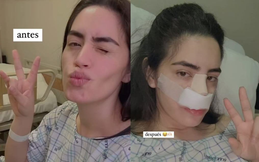 El antes y el después de Ruth Barrios. Foto: Gentileza