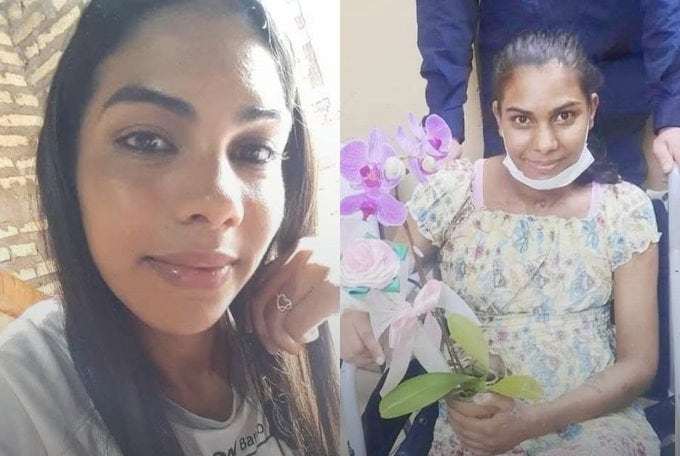 La joven estuvo internada en terapia y recibió varias cirugías para su recuperación. Foto: Gentileza