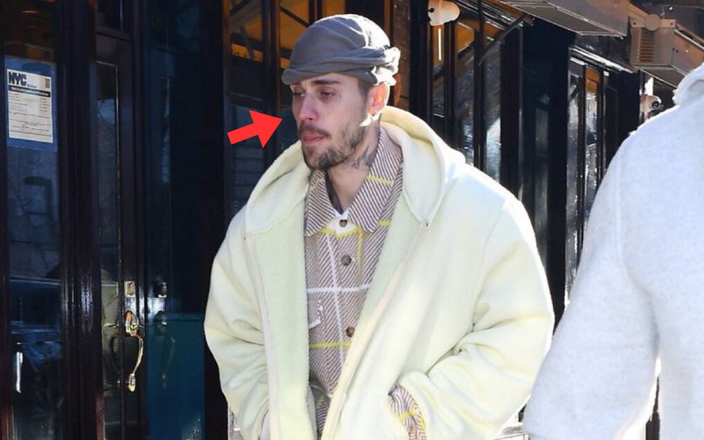 Preocupación por la salud de Justin Bieber tras sus últimas apariciones públicas. Foto: Gentileza