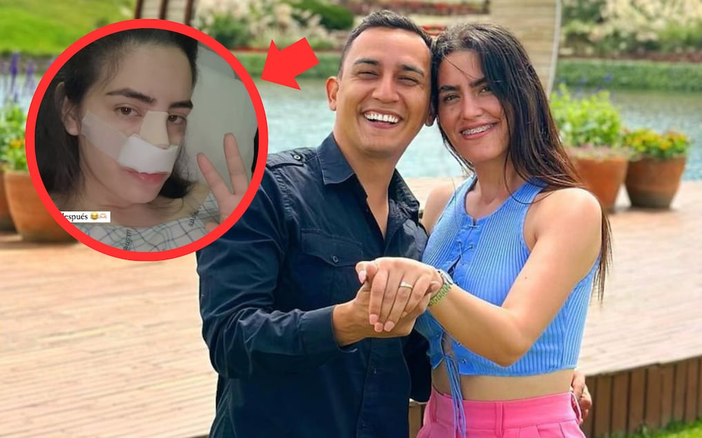 Novia de Mariano López sin miedo, reveló en Instagram que se sometió a una operación estética. Foto: Gentileza