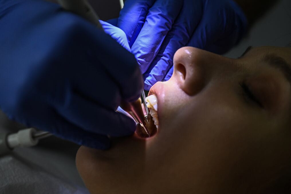 Investigadores japoneses desarrollan un medicamento que podría estimular las raíces de una tercera generación dental. Foto: Ozan Kose/AFP