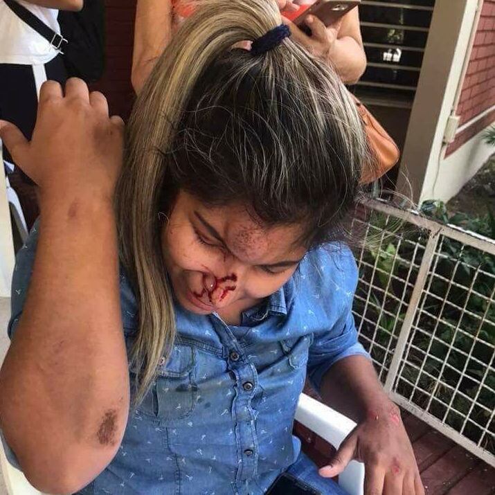 Nathalia Fariña sufrió un importante corte en el rostro al caer contra el pavimento. Foto: Gentileza