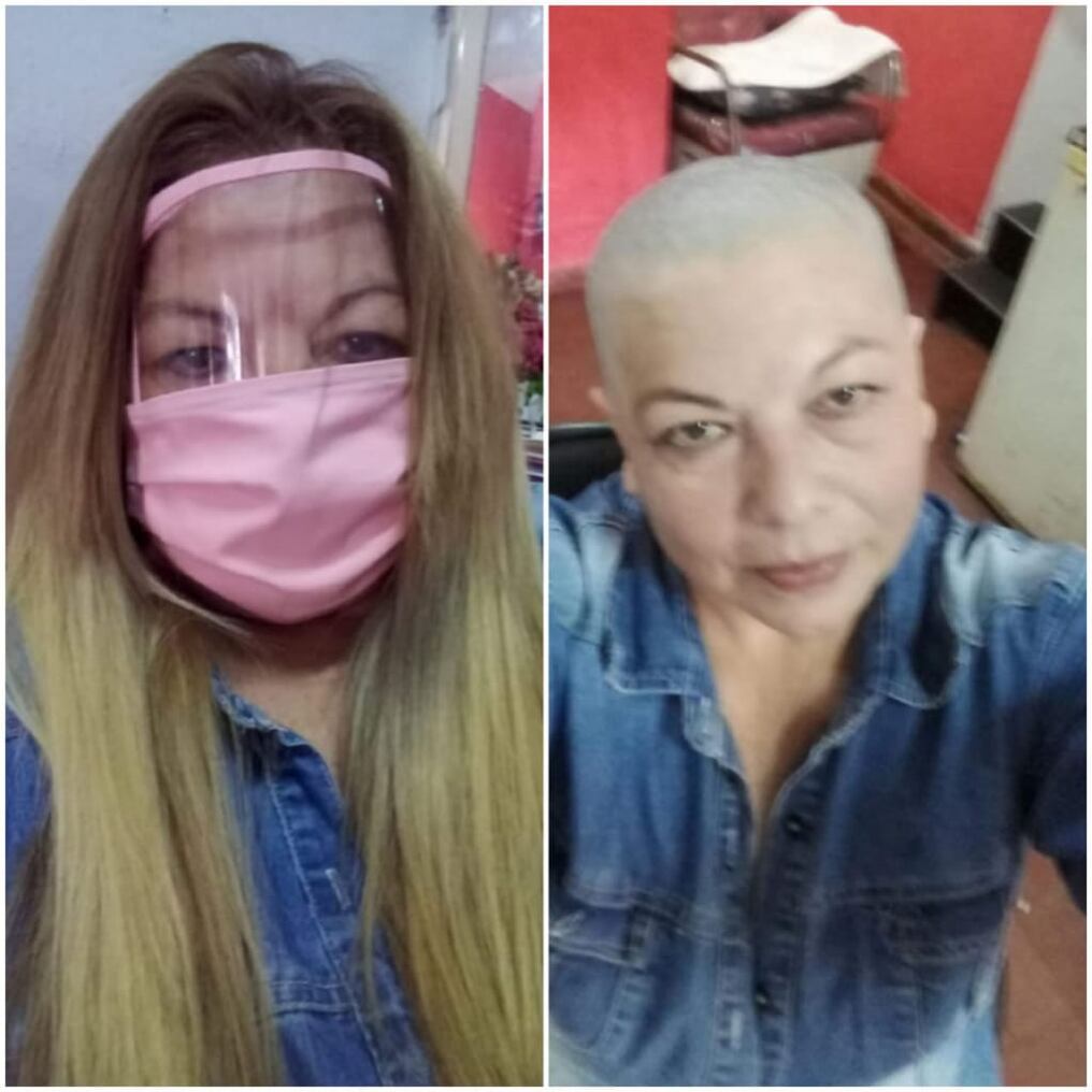 El antes y después. Foto: Gentileza.