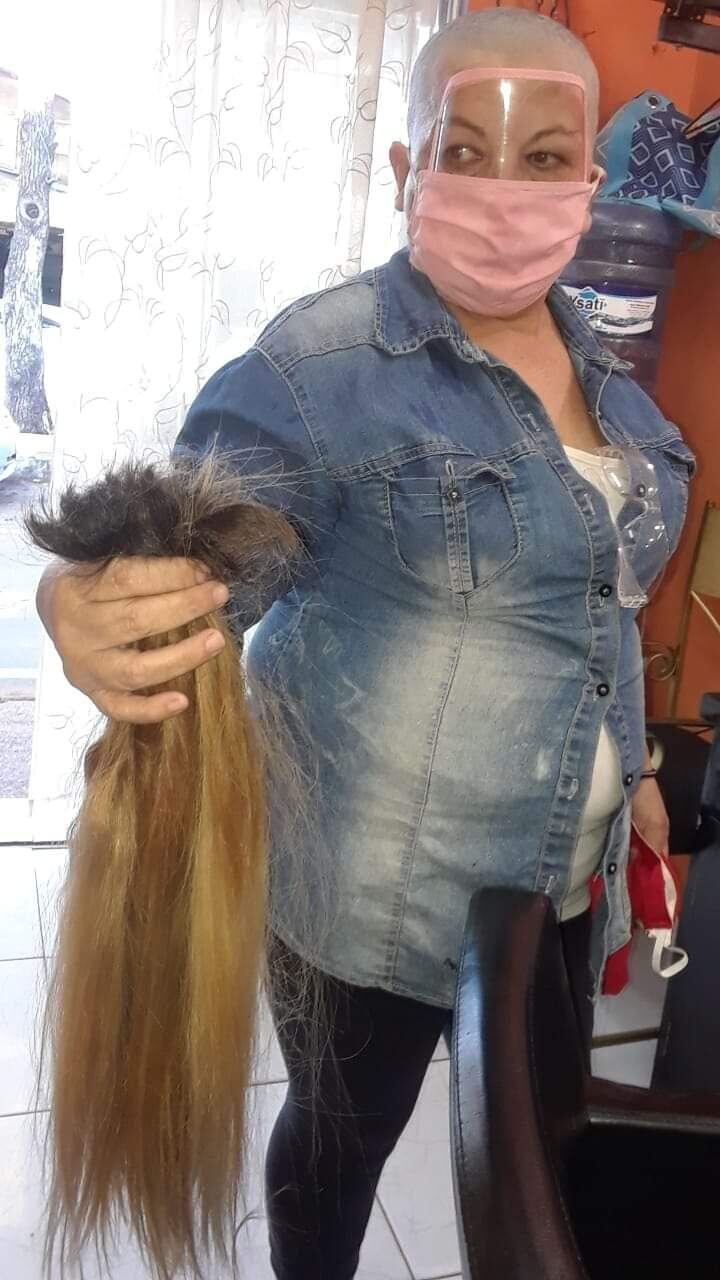 Antonia "Yoddy" Rojas es una activista social de San Lorenzo. Decidió raparse la cabeza como muestra de apoyo al ministro de Salud, Julio Mazzoleni. Foto: Gentileza.