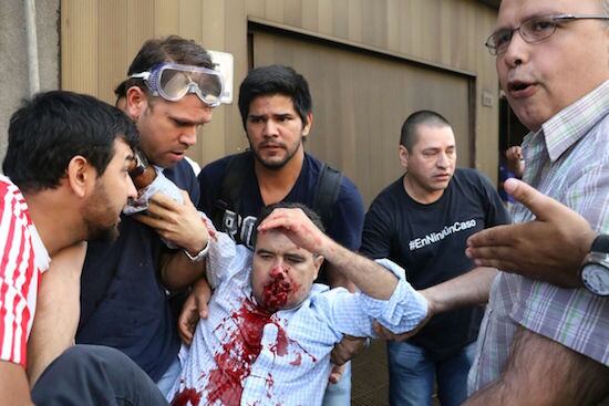 El diputado Édgar Acosta fue herido en el rostro.foto: gentileza