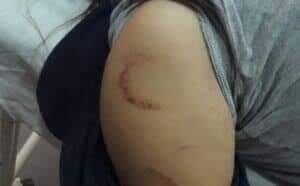 La mujer presentaba golpes en varias partes del cuerpo. Foto: Gentileza.