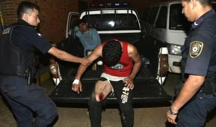 Los detenidos fueron llevados al hospital Regional de Luque para los primeros auxilios y luego puestos a disposición de la Fiscalía.