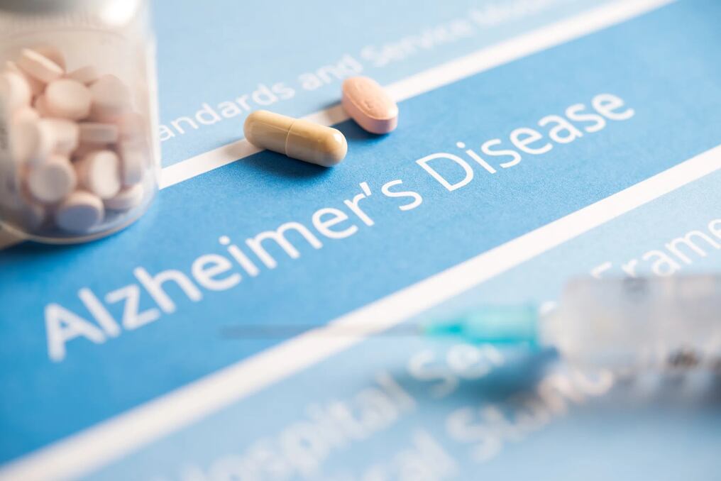 Un proyecto de medicamento contra la enfermedad de Alzheimer, a partir de una pista aún poco explorada, suscita unas tímidas esperanzas de tratamiento, tras veinte años de escasos avances en este difícil campo. Foto: Ilustrativa.