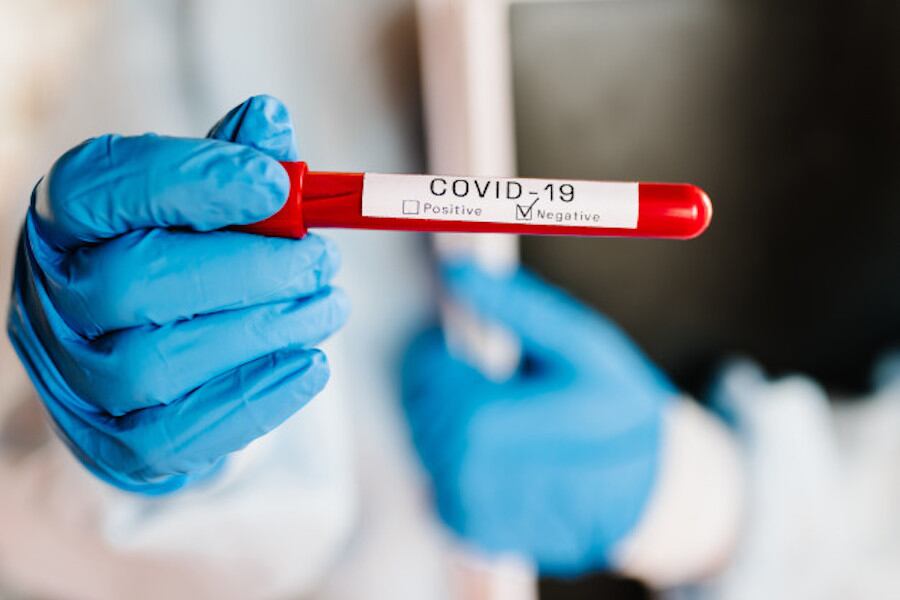 Luego de registrarse un caso positivo del nuevo coronavirus, el servicio se reactiva hoy en vista a que los funcionarios que se han realizado la prueba al COVID-19 dieron negativo. Foto: Gentileza (Ilustrativa)