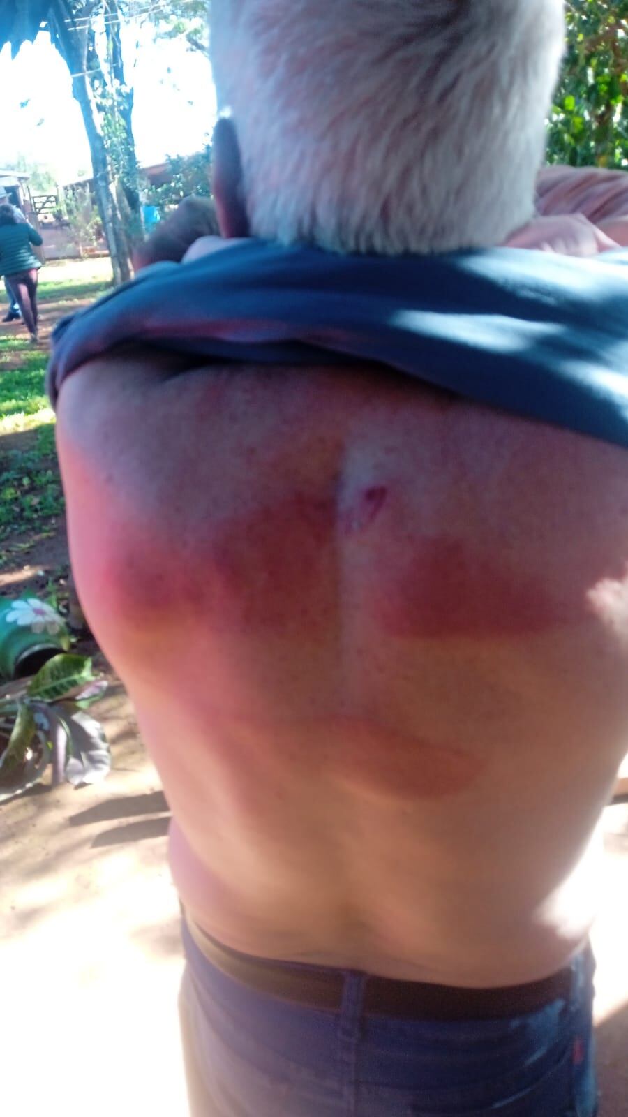 Pedro Torrás, propietario del establecimiento, fue derivado al Centro de Salud de San Alberto por las heridas recibidas. Foto: Gentileza.