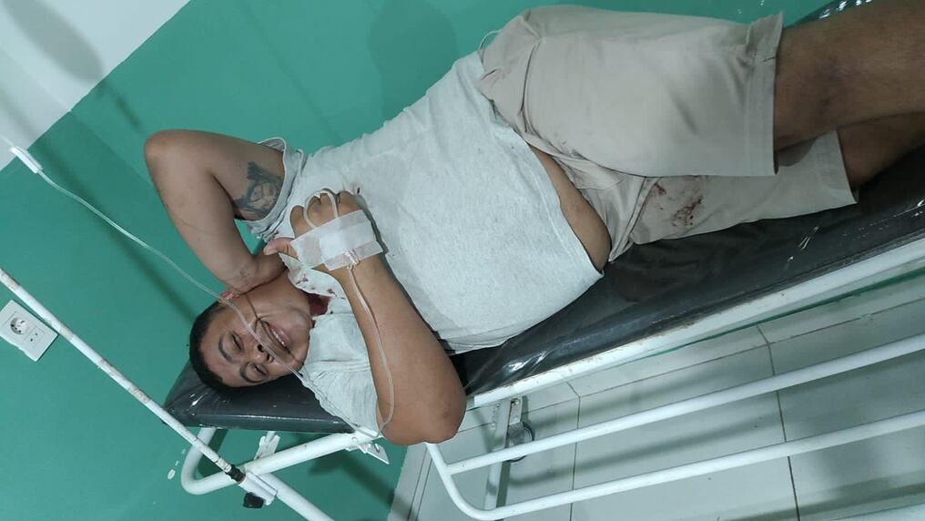 Marcelo Monteggia es uno de los heridos en el anfiteatro José Asunción Flores de la ciudad de San Bernardino el pasado domingo y estaría involucrado en un caso de homicidio en Bolivia. Foto: Gentileza.