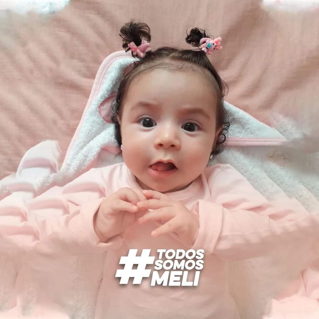 Meli es una hermosa beba de 7 meses de la colonia Blas Garay de Coronel Oviedo, diagnosticada con atrofia muscular espinal (AME), tipo 1. Sus padres lanzaron la campaña que apunta a recaudar la suma de US$ 2.200.000 para adquirir el Zolgensma. Foto: Gentileza.