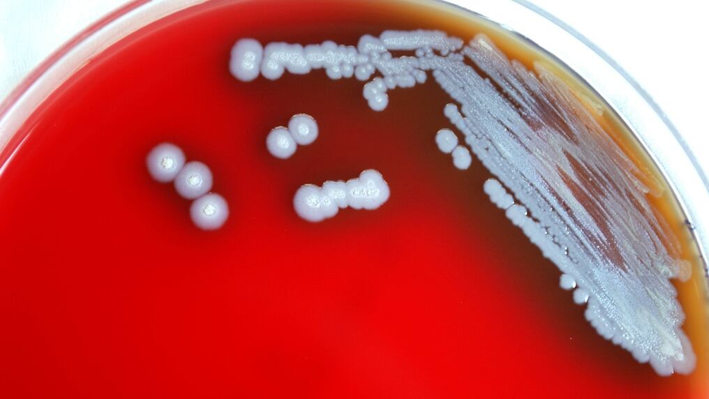Dos casos de melioidosis humana llevó a la detección de la Burkholderia pseudomallei en charcos del sur de Misisipi. Foto: Gentileza.