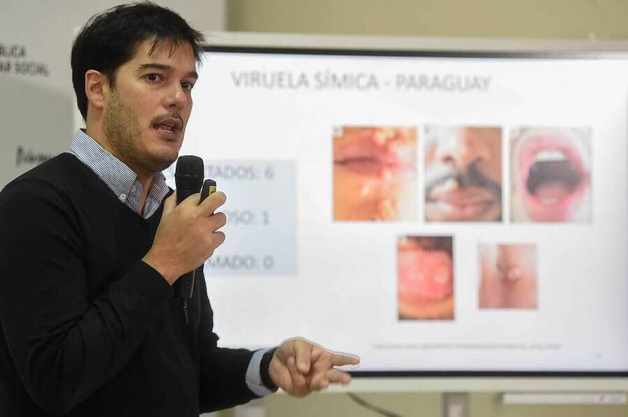 El director de Vigilancia de la Salud, Guillermo Sequera, manifestó que pese al descenso de contagios, no disminuye la cantidad de fallecidos. Foto: Gentileza.