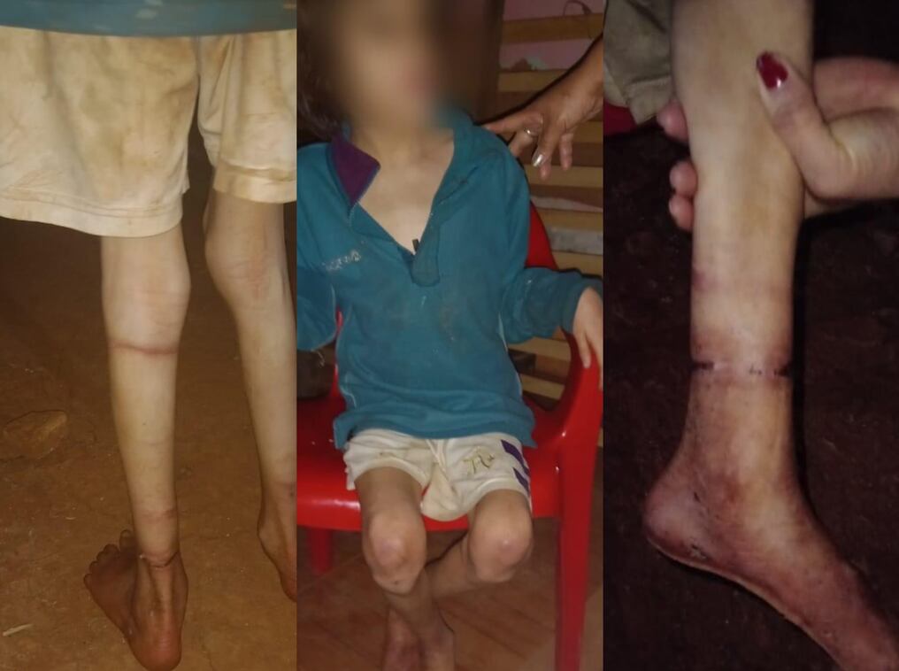 La niña tenía signos de desnutrición y lesiones en las piernas. Foto: Radio Activa Rosario FM.