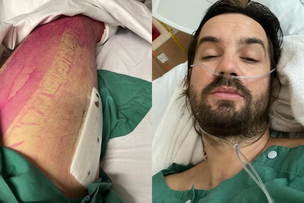 Kevin Parker se encuentra hospitalizado tras una factura. Foto: Gentileza.