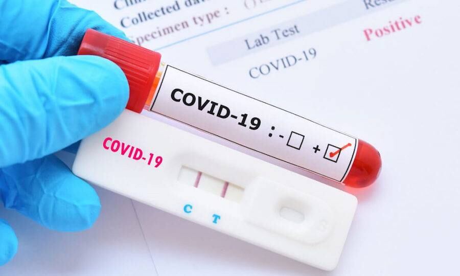 En la última semana epidemiológica se han procesado en total unas 13.723 muestras, de esta cifra, 1.349 tuvieron un resultado positivo. Foto: Ilustrativa.