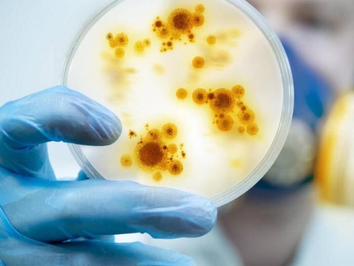 En términos de suministro, Estados Unidos tiene cerca de mil dosis del compuesto JYNNEOS, una vacuna aprobada por la Administración de Alimentos y Medicamentos de Estados Unidos (FDA) para la viruela común y la viruela del mono. Foto: Internet.