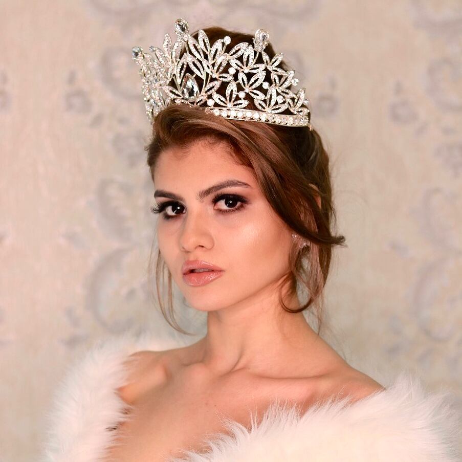 La Miss Tierra Paraguay 2021, Evelyn Andrade sufrió una descompensación y no pudo participó de la gala final de Miss Earth. Foto: Gentileza.
