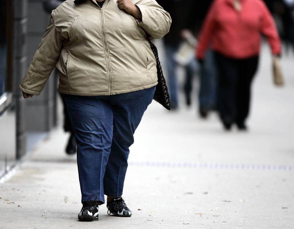 La obesidad y el sobrepeso son problemas que tienen ribetes de pandemia. Foto: Archivo