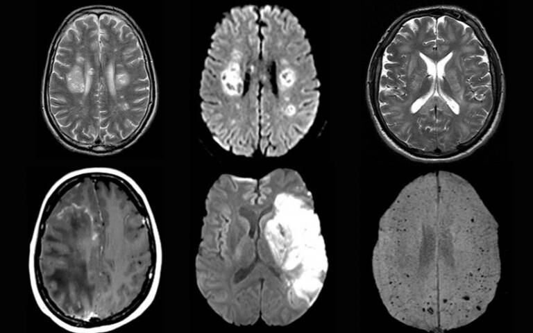 Imágenes de escaneo cerebral del estudio, publicadas en la página de la universidad. Foto: Gentileza.