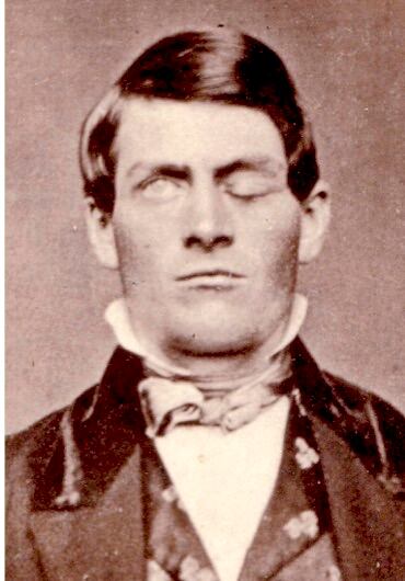 El apasionante caso de Phineas Gage