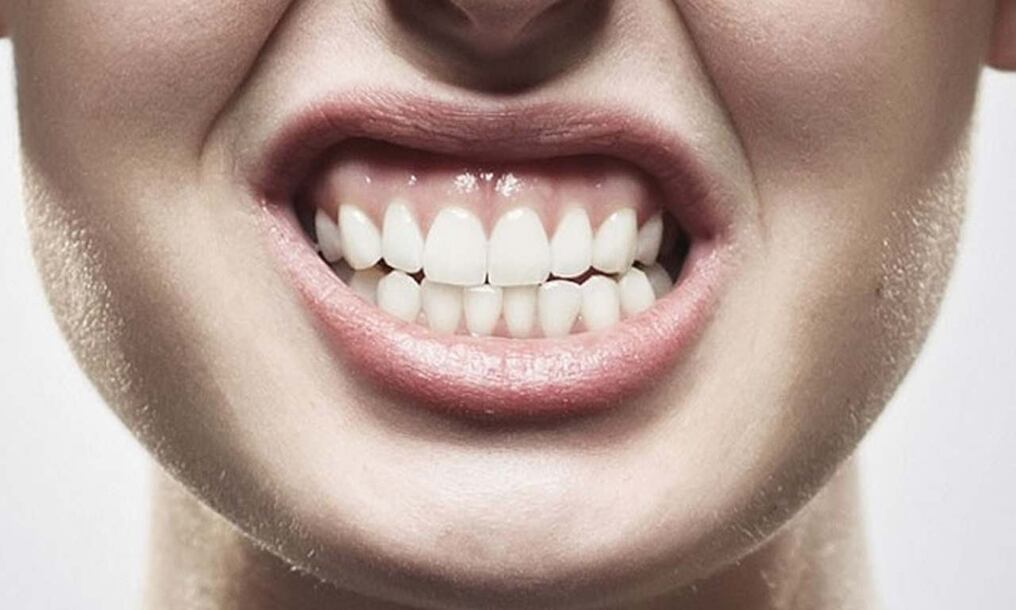 La afección bucal se origina a causa del estrés o ansiedad. Foto: Gentileza.